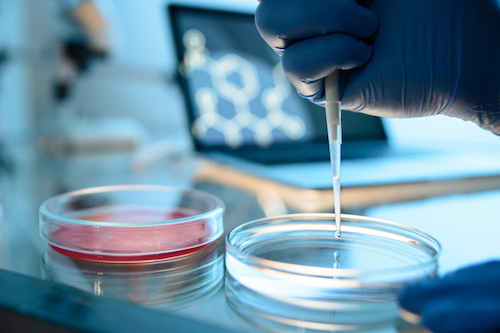 微刺激与常规促排方案在IVF-ET中的效果