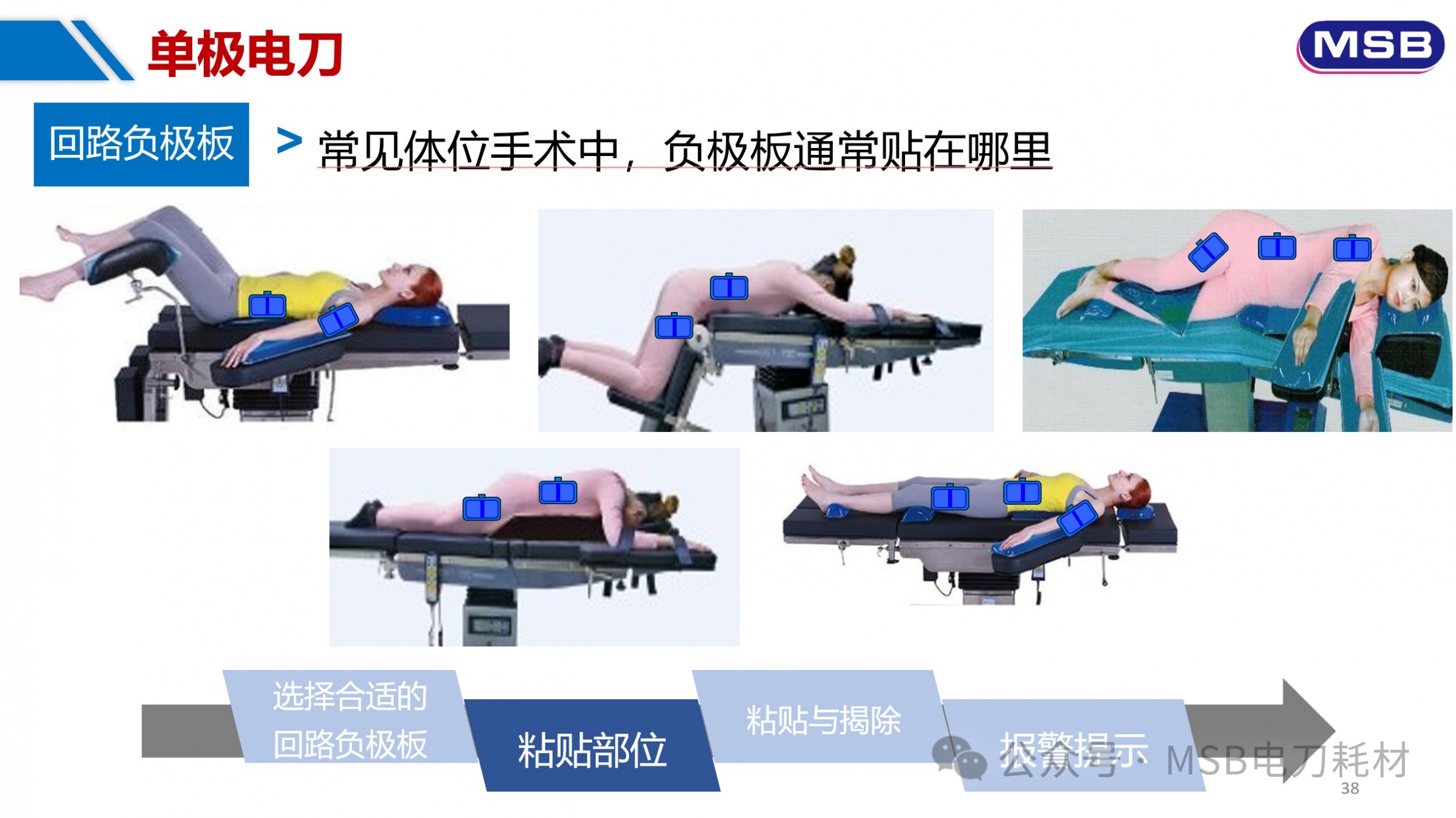 一例电刀负极板灼伤患者的原因分析与对策