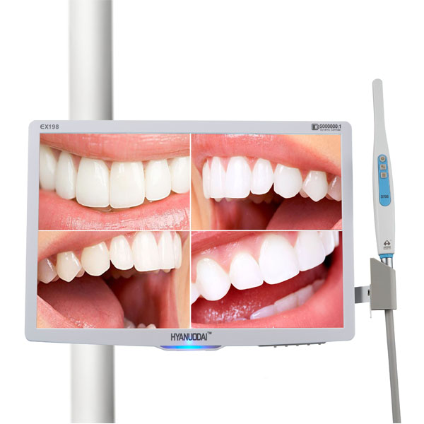 Intraoral Camera with 18.5inch Multimedia LED Monitor