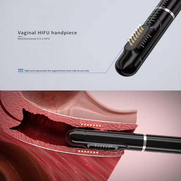 4 IN 1 hifu Treatment technology HIFU eye around Vaginal Tightness Liposonix body shape pore contraction