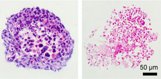 Acellular embryoid body and hydroxybutyl chitosan composite hydrogels promote M2 macrophage polariza