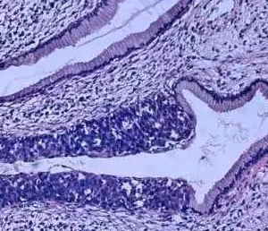 全球***个指南：接种 HPV 预防宫颈癌