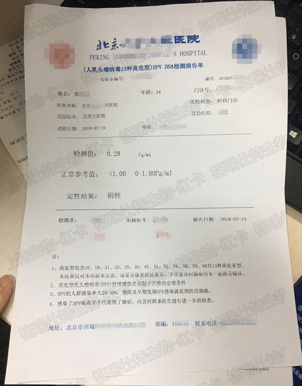 使用红卡后HPV58阳性转阴，TCT由LSIL转变为NILM