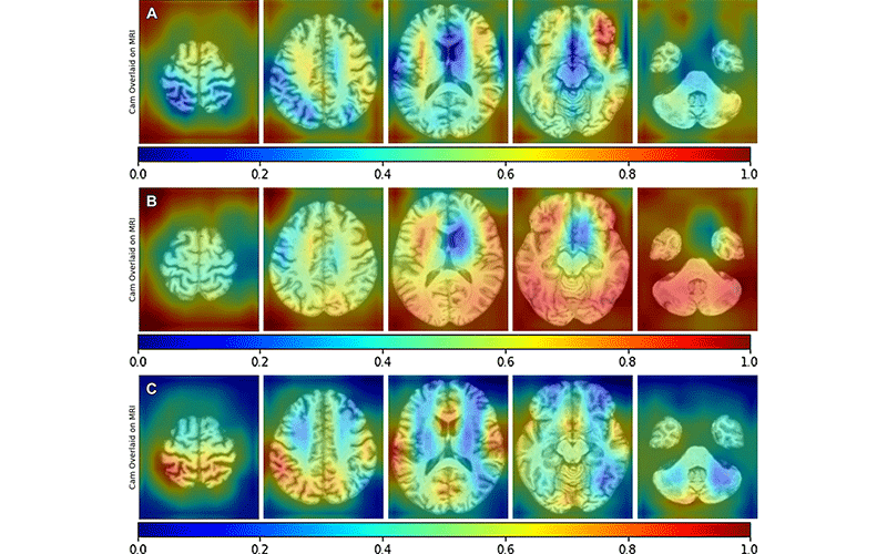 MRI-Based Deep Learning Predicts Markers of Alzheimer's Disease