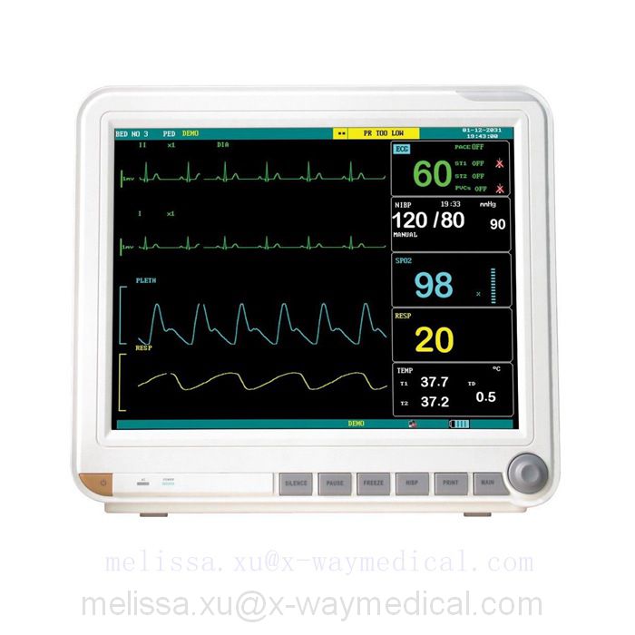 15” 15 inch TFT Display patient monitor PETCO, Surgery room ICU CCU bedsie monitor machine with 7 parameter for Adult children newborn