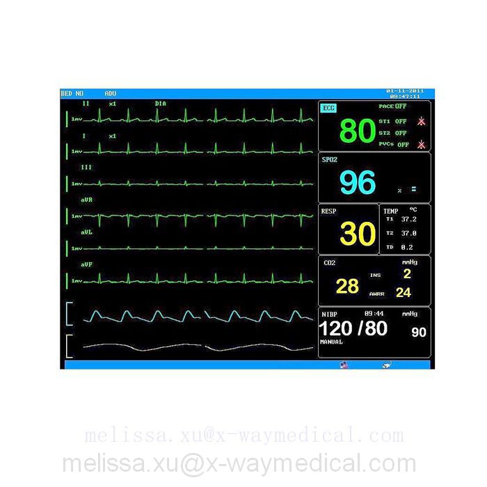 15” 15 inch TFT Display patient monitor PETCO, Surgery room ICU CCU bedsie monitor machine with 7 parameter for Adult children newborn