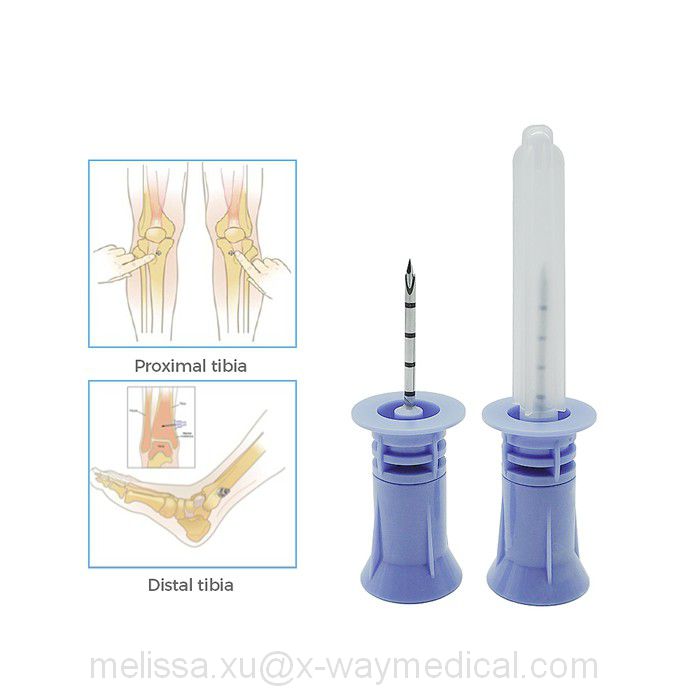 Disposable Bone Marrow Infusion Sets, 29G - 33 g 4mm - 12mm thin wall proximal tibia puncture injection needle