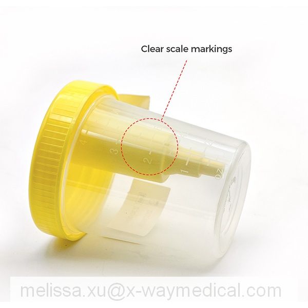 Threaded Vacuum Urine Cup, leakage resistance urinary specimen container, urine sample delivery tube
