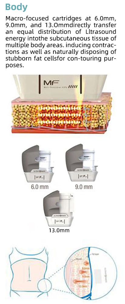Precision Ultrasound for Targeted Treatment
