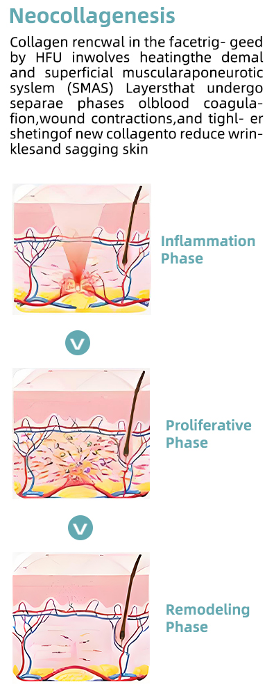 Precision Ultrasound for Targeted Treatment