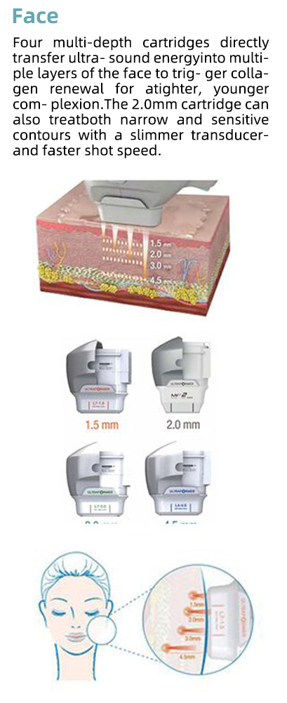 Precision Ultrasound for Targeted Treatment
