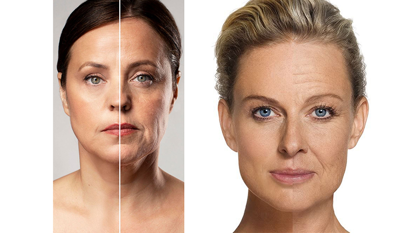Smoother, Tighter Skin