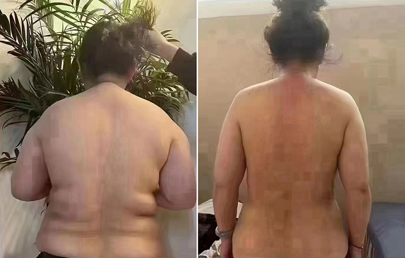 Long-Lasting Results