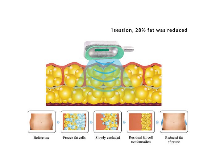 Effective Fat Reduction