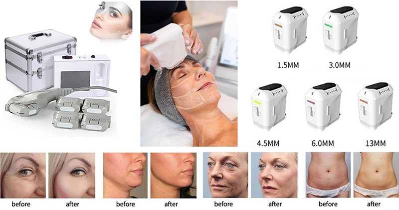 Versatile Treatment for Any Occasion
