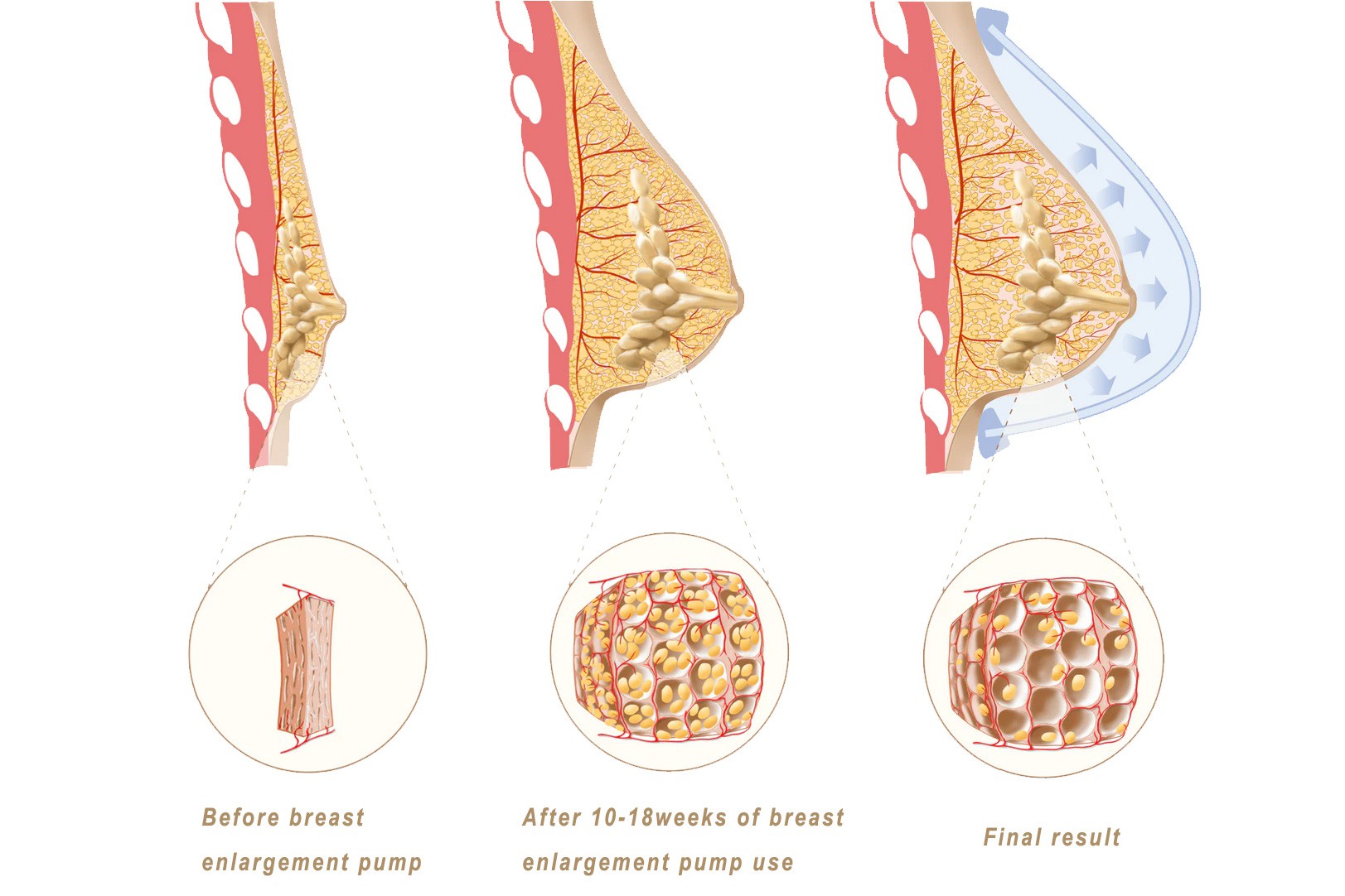 Proven 1-2 cup size increase