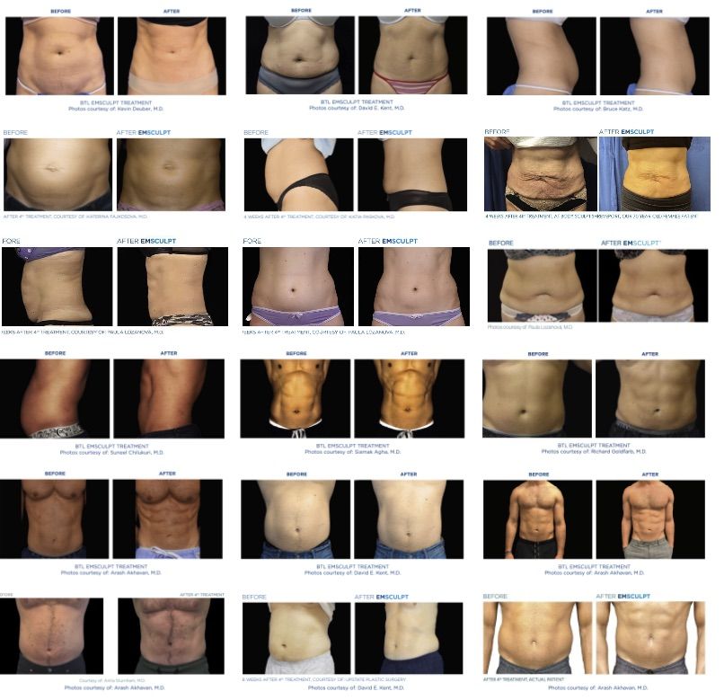 Fast Visible Results