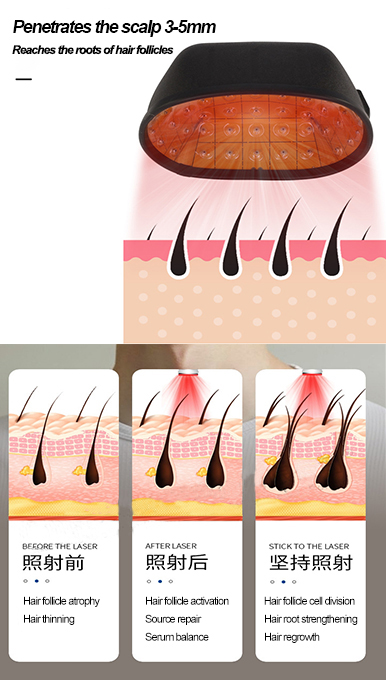  Ubeautnow Hair Growth Helmet 