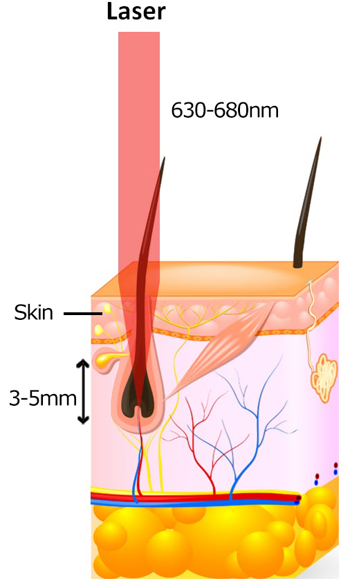 Use Clinically Proven Wavelengths (630–680nm)