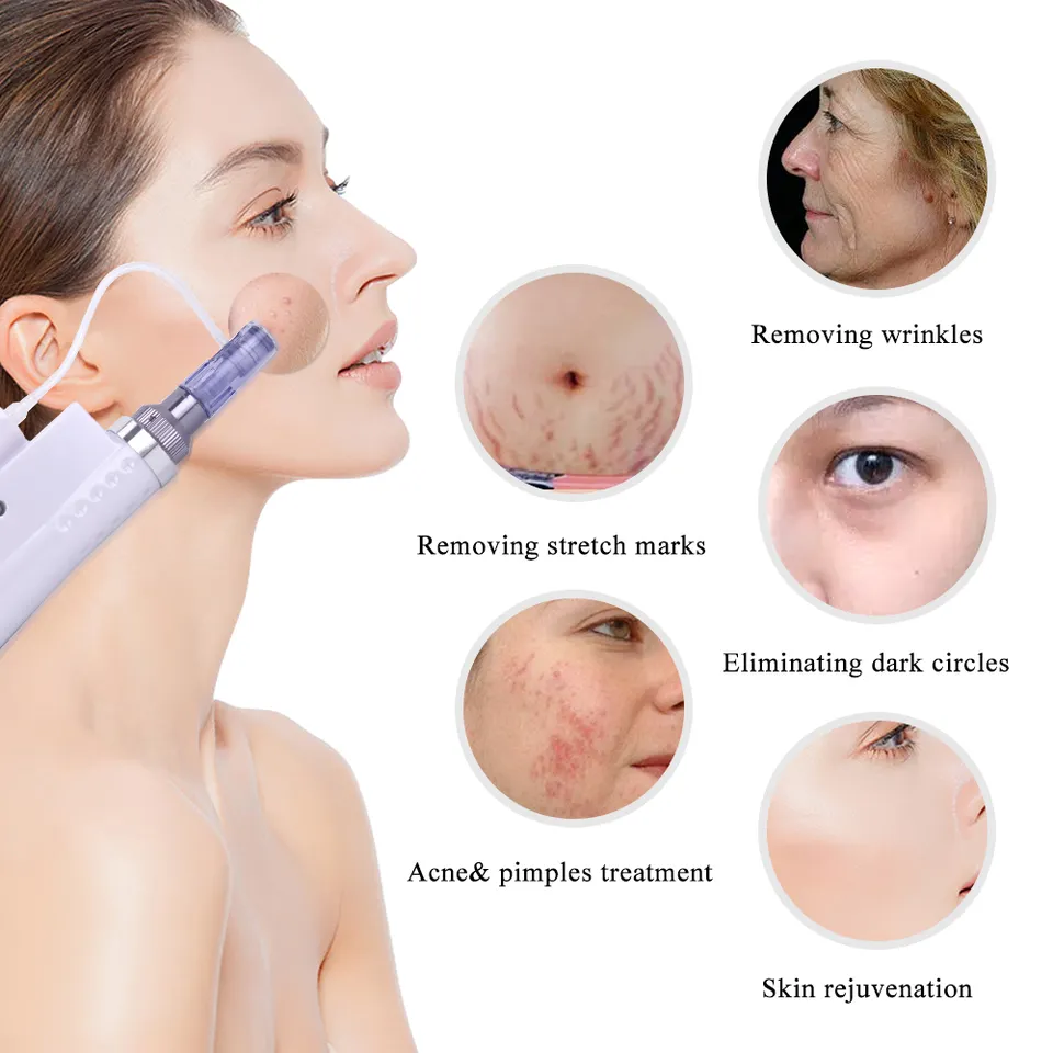 UMF0063 Ubeautnow 2 in1 Mesotherapy Nano Micro Needle Derma Pen