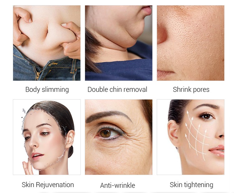 Ubeautnow 360 Fat Freezing Cavitation Machine – RF Lipolaser Body Contouring Device