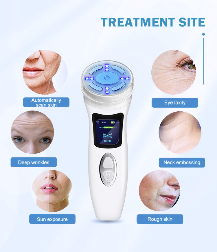 UF0106 Ubeautnow 4th Gen Mini HIFU Machine – Non-Surgical Face Lift & Skin Tightening Device for Home Use