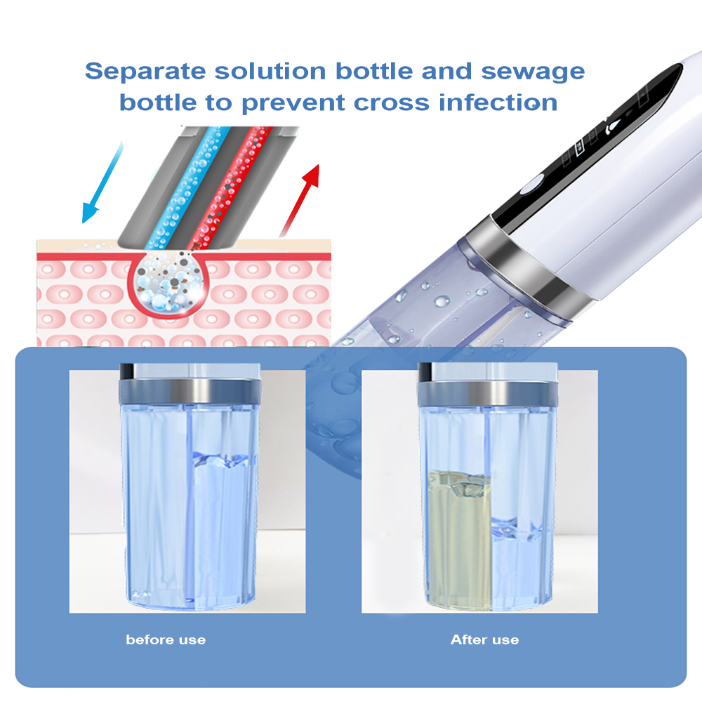 Electric Blackhead Remover with Strong Suction – Deep Pore Vacuum Cleaner