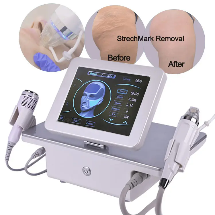 Ubeautnow RF Microneedle Skin Rejuvenation Machine – Fractional Microneedling Anti Aging Device