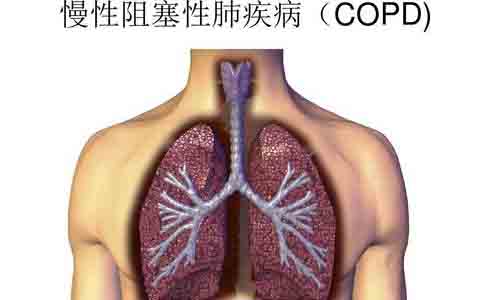 在鱼龙混杂的制氧机市场该怎么选择适合医疗制氧机