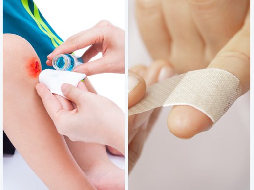 Acupoint application therapy and applicator