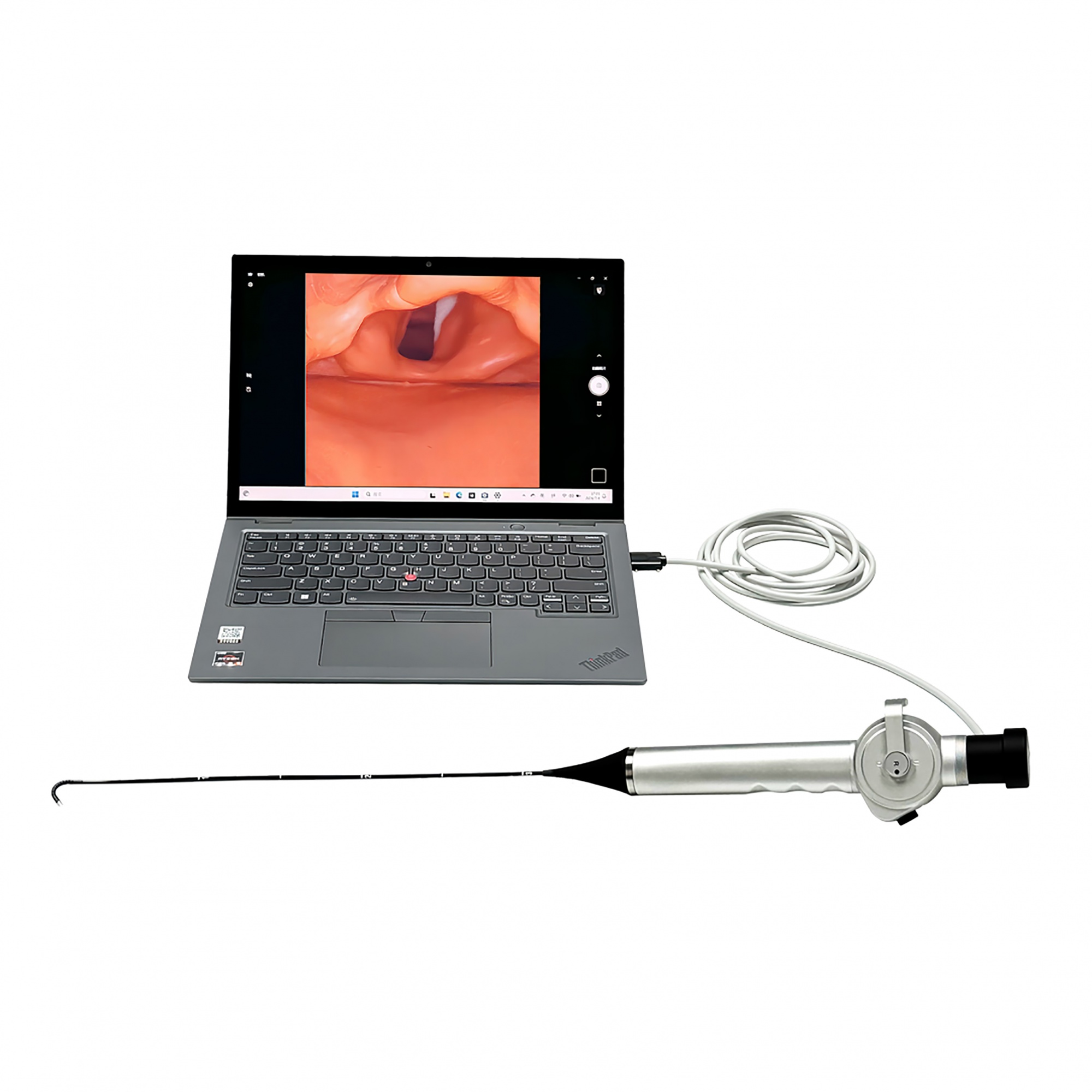 USB Rhinolaryngoscope