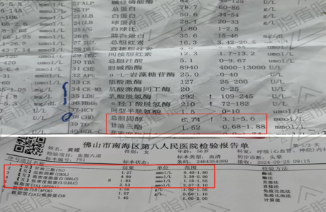 佛山黄姐 胆固醇，甘油三酯超标