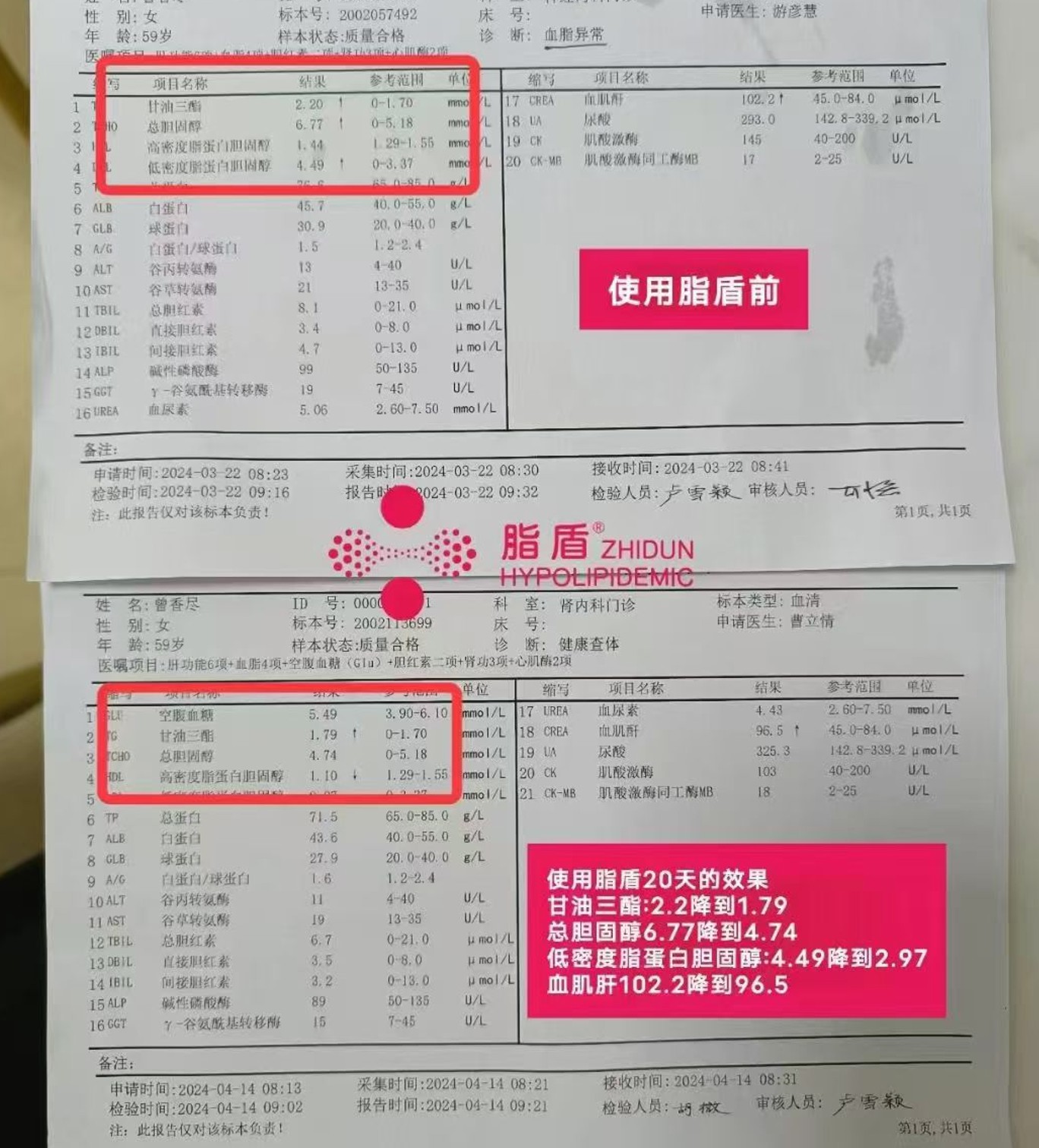 59岁曾女士，血脂四项超标 用脂盾20天效果