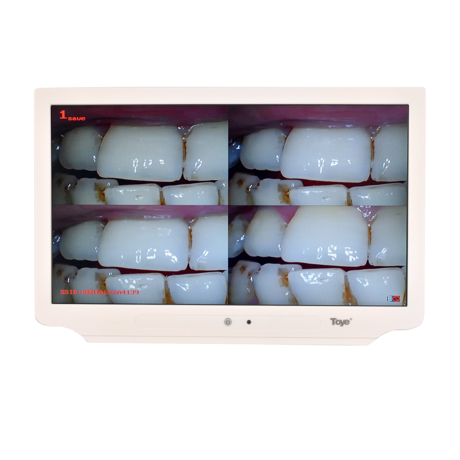 TY-E5
