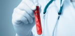 A competition for cancer cells and human medical testing – How to use liquid biopsy to break through the testing dilemma?