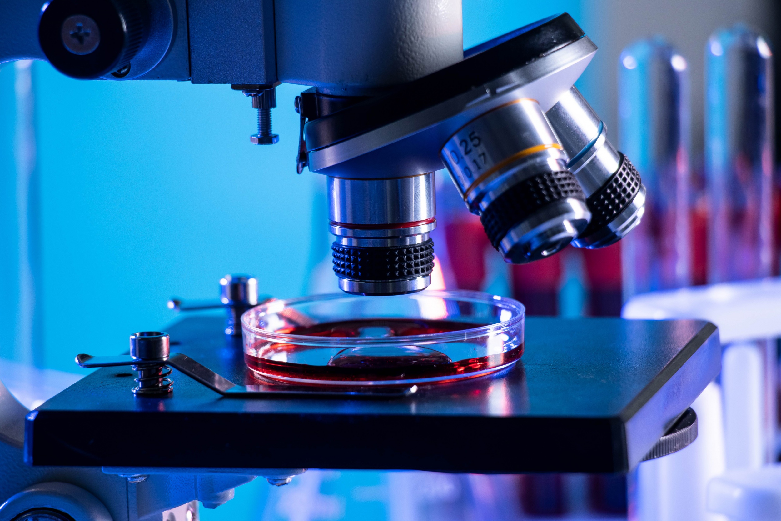 Blood Donation Screening Solutions 