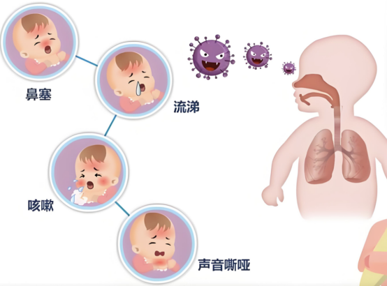【注意】这几类宝宝正在被合胞病毒锁头，请家长警惕！！！