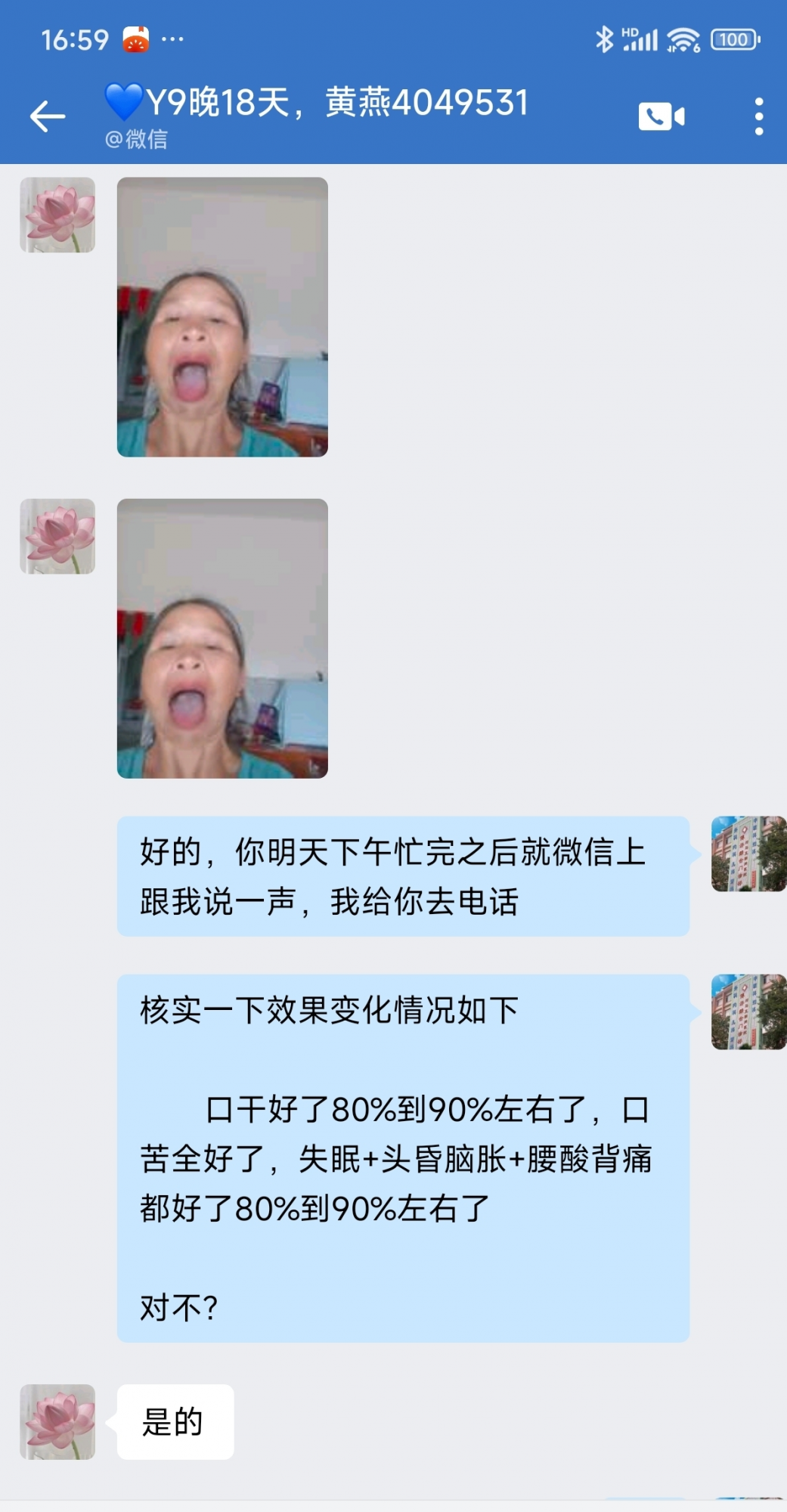 广东省茂名市4049531黄女士耳鸣听力下降