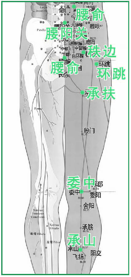 腰肌劳损治疗指南