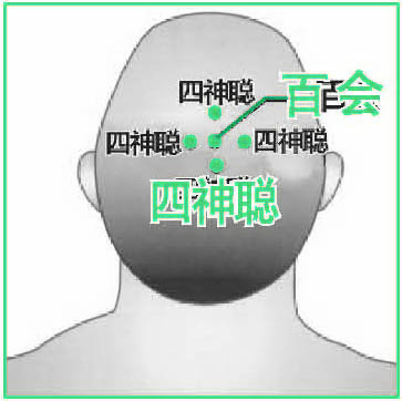 头痛2.jpg