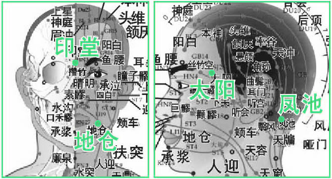神经性头痛治疗指南